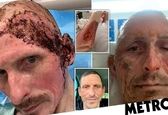 مواد ضدعفونی کننده بلای جان راننده تاکسی شد +عکس