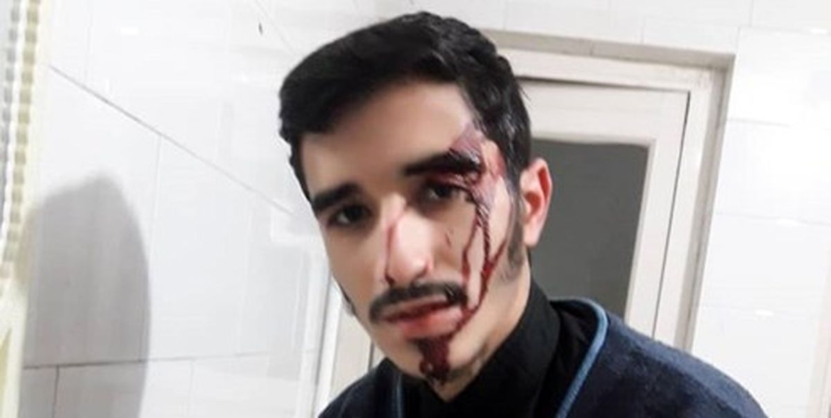 ضرب و شتم طلبه بسیجی در تهران +عکس