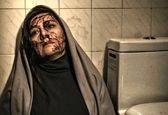 صورت چاقو خورده هنگامه قاضیانی +عکس 